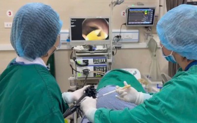 Thường xuyên ăn thịt bò tái, đi khám, người đàn ông phát hiện sán dây bò dài 1,2 mét trong ruột