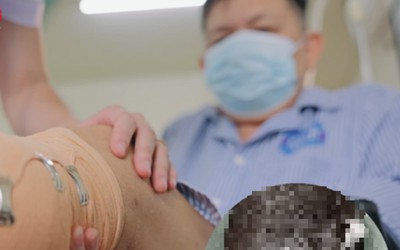 Nghe lời truyền miệng, ngâm chân nước trà xanh nóng, người đàn ông 66 tuổi phải cắt cụt chân