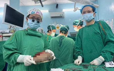 Bé 5 ngày tuổi có khối u quái nặng 1,3 kg