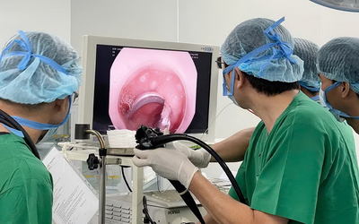 Bé 3 tuổi đau bụng, bác sĩ phát hiện "vật lạ" mắc trong tá tràng