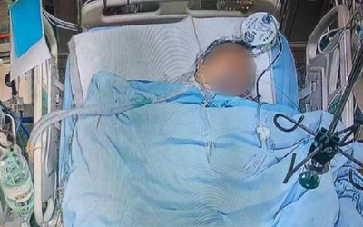 Người đàn ông 30 tuổi tử vong sau 10 năm ăn sáng theo kiểu "vạn người mê"