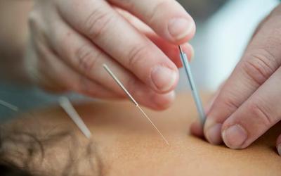 Đau chân dữ dội sau khi châm cứu, người phụ nữ sốc nặng khi biết sự thật đáng sợ