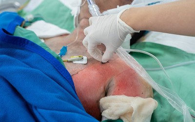 Tình trạng sức khỏe các nạn nhân vụ cháy nhà khiến 2 người tử vong