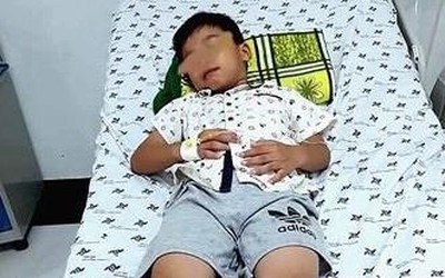 Ngậm kẹo ngủ quên, bé trai 7 tuổi nuốt que nhựa dài 7,5cm vào bụng