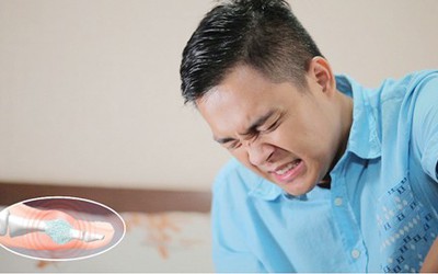 Vì sao người mắc bệnh Gout ngày càng trẻ hóa?