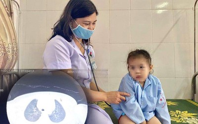 Bé trai 3 tuổi ho liên tục, khó thở vì nút bấm điều khiển nằm trong khí quản