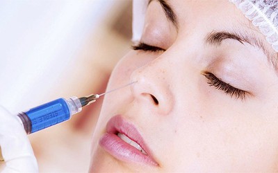 Hotgirl liệt nửa mặt sau khi làm đẹp bằng filler