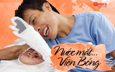 [E] Niềm hy vọng ở viện Bỏng