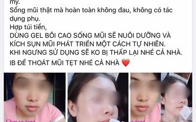 Hoại tử vì dùng “thần dược thiên nhiên” nâng mũi dọc dừa