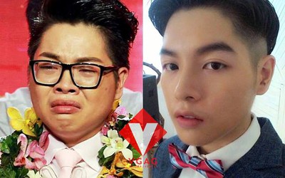 Phẫu thuật thẩm mỹ không phải là đặc quyền của nữ giới