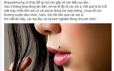 Xăm tẩy nốt ruồi phong thủy: Cẩn thận “tiền mất, tật mang”