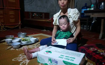 Lễ Vu Lan: Nghẹn lòng người mẹ mong được đau thay con mình