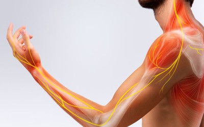 Bệnh viêm đa dây thần kinh nguy hiểm mức nào?