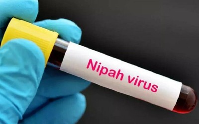 Bangladesh ghi nhận ca tử vong đầu tiên do virus Nipah trong năm 2024