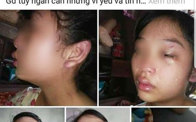 Vụ cô gái 16 tuổi tố bị chồng đánh: Người chồng có thể bị truy cứu tội Giao cấu với trẻ em