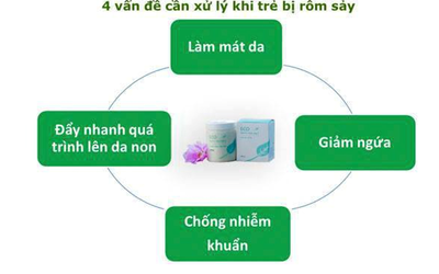 4 yếu tố quan trọng khi chữa rôm sảy, mẩn ngứa cho trẻ