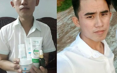 Chàng trai 9X với hành trình thoái khỏi nỗi ám ảnh da mụn