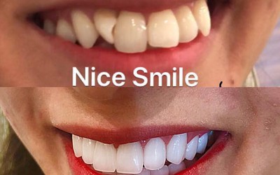 Nice Smile - Sứ mệnh mang tới nụ cười chinh phục con tim