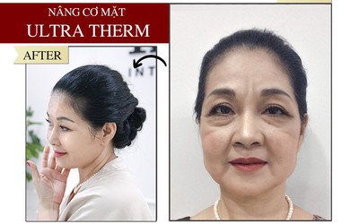 Ultra Therm – Công nghệ trẻ hóa làn da, kéo dài thanh xuân