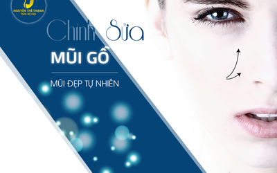 Chỉnh sửa mũi gồ, mũi đẹp tự nhiên