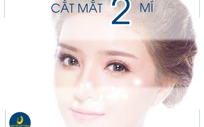 Cắt mắt 2 mí ở đâu đẹp?