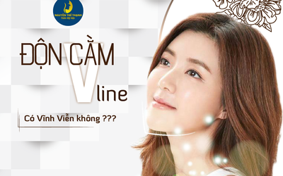 Độn cằm V-Line có được vĩnh viễn không?