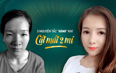 5 nguyên tắc "vàng" cắt mắt 2 mí nhất định bạn phải biết