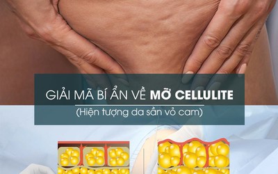 Xóa tan ám ảnh da sần vỏ cam sau hút mỡ tại D’vincy