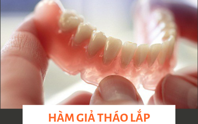 Răng không mọc được toàn hàm là bệnh gì? Chữa như thế nào?