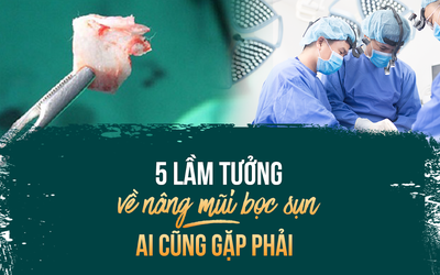 5 lầm tưởng về nâng mũi bọc sụn ai cũng gặp phải