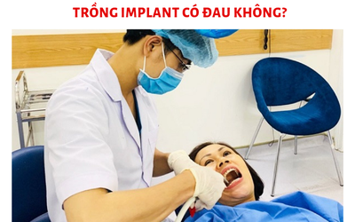 Trồng răng Implant “rất đau” có phải là lầm tưởng?