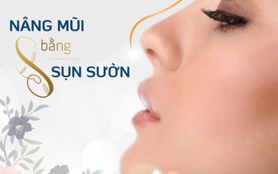 Nâng mũi bằng sụn sườn