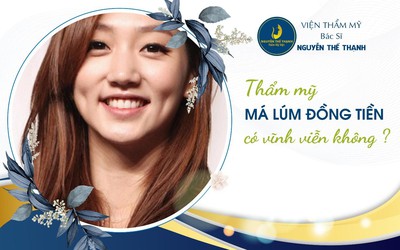 Thẩm mỹ tạo má lúm đồng tiền có duy trì vĩnh viễn không?