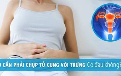 Chụp tử cung vòi trứng có đau không?