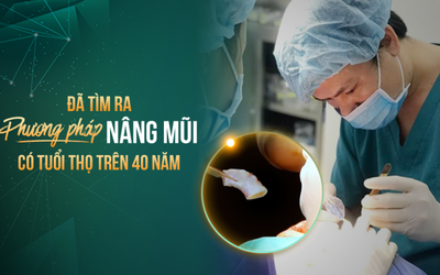 Đã tìm ra phương pháp nâng mũi có tuổi thọ trên 40 năm