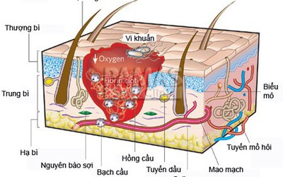 80% hôi nách liên quan đến di truyền