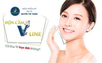 Độn cằm V-line có duy trì trọn đời không?