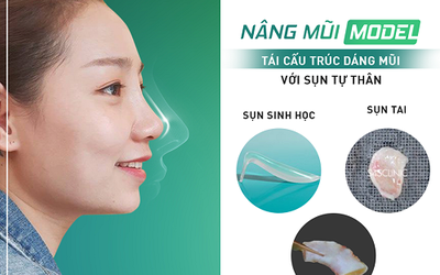 Nâng mũi sụn tự thân liệu có an toàn tuyệt đối 100%?