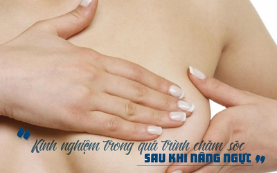 Kinh nghiệm trong quá trình chăm sóc sau nâng ngực bạn cần biết