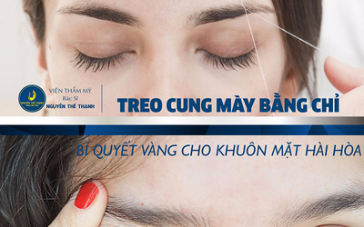 Treo cung mày bằng chỉ – Bí quyết vàng cho khuôn mặt hài hoà