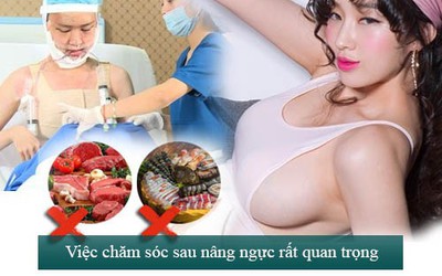 Nâng ngực chảy xệ nội soi, giải pháp gọn nhẹ cho Eva bận rộn