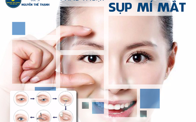 Phẫu thuật sụp mí mắt - Lấy lại đôi mắt hút hồn