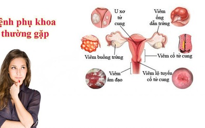 Điểm mặt các bệnh phụ khoa nguy hiểm thường gặp nhất ở nữ giới?