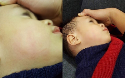 Bác sĩ tát bé trai 22 tháng tuổi: Khi lương y “bị ốm”