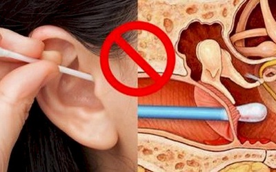 Nhỏ vài giọt oxy già, khỏi phải lo ngay ngáy khi lấy ráy tai