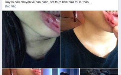 Vụ anh rể bạo hành em vợ: Cái giá của sự "đánh đu" với cộng đồng mạng?!