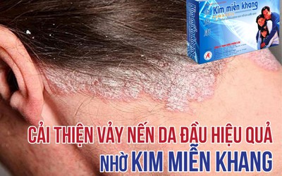 Kim Miễn Khang & Explaq - Cải thiện vảy nến da đầu hiệu quả