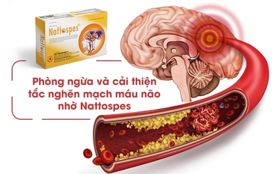 Phòng ngừa và cải thiện tắc nghẽn mạch máu não nhờ Nattospes