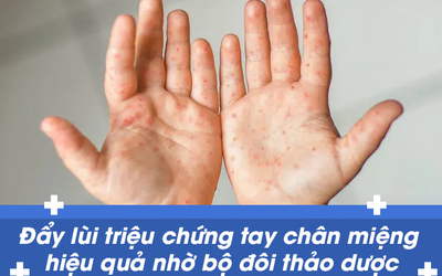 Đẩy lùi triệu chứng tay chân miệng hiệu quả nhờ bộ đôi thảo dược