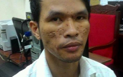 Vì sao kẻ đồng tính hành hạ dã man bé trai 2 tuổi ở Campuchia được tại ngoại?